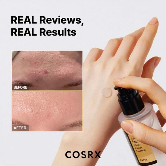 Cosrx Snail Mucin Essence 100ml - Ser Coreean cu 96% Mucină de Melc pentru Ten Luminos și Fără Imperfecțiuni
